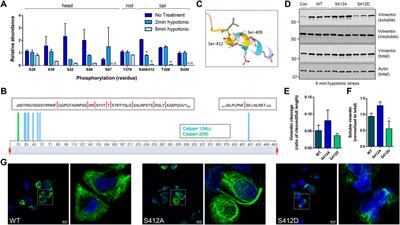 Calpain-mediated proteolysis of vimentin filaments is augmented in giant axonal neuropathy fibroblasts exposed to hypotonic stress